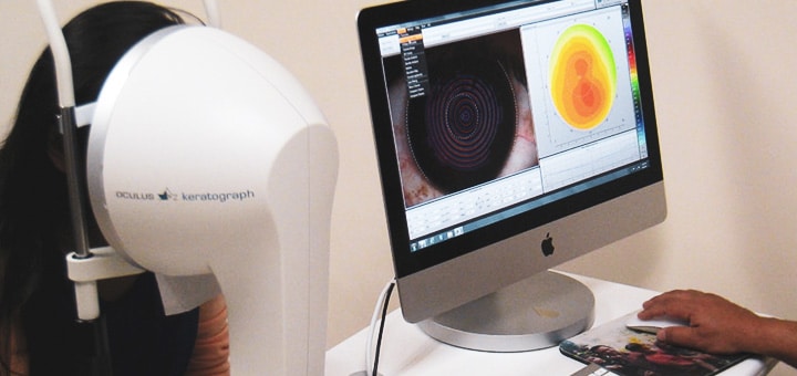 topografia corneal