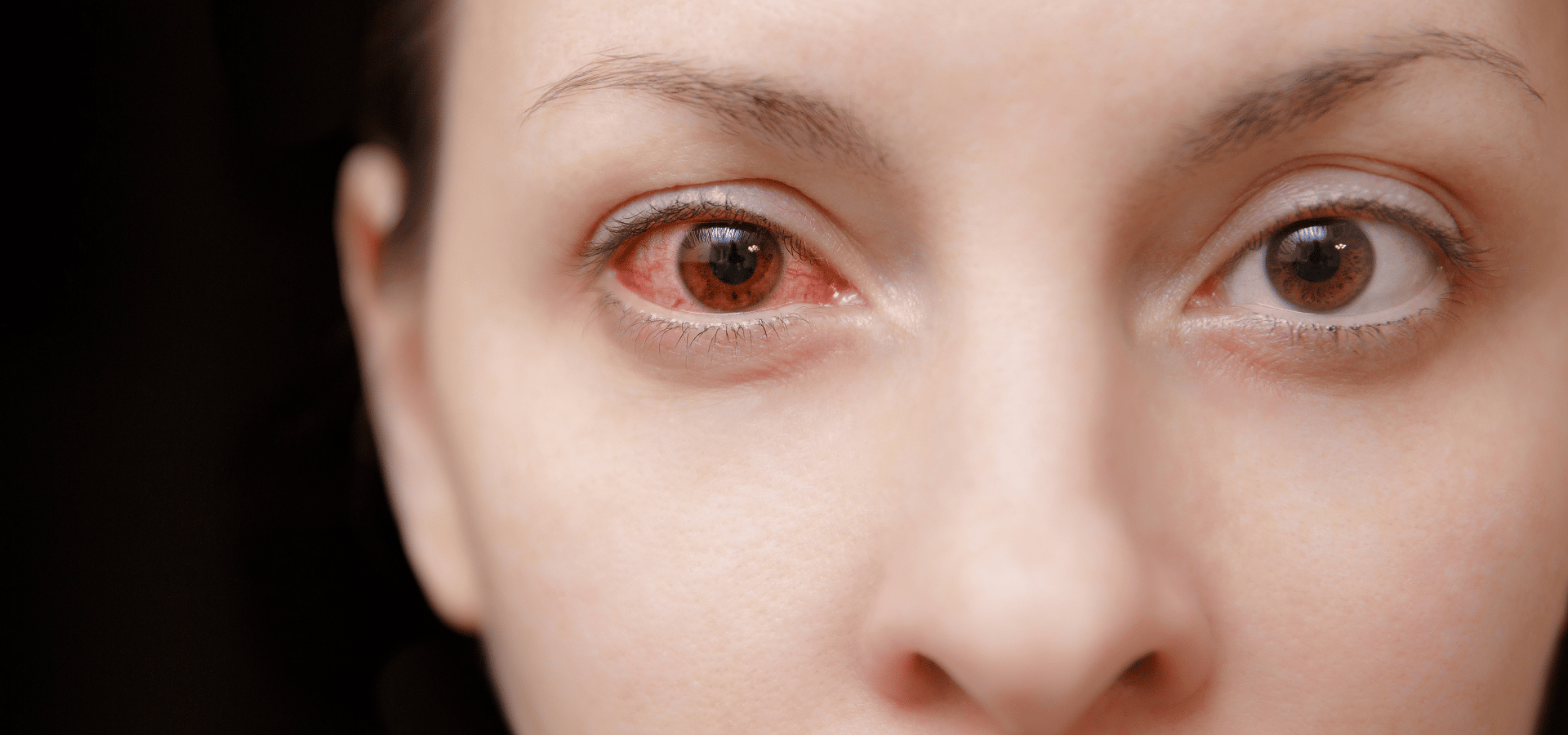 ¿Cuáles son las 10 enfermedades de la vista más comunes? » enfermedades de la vista