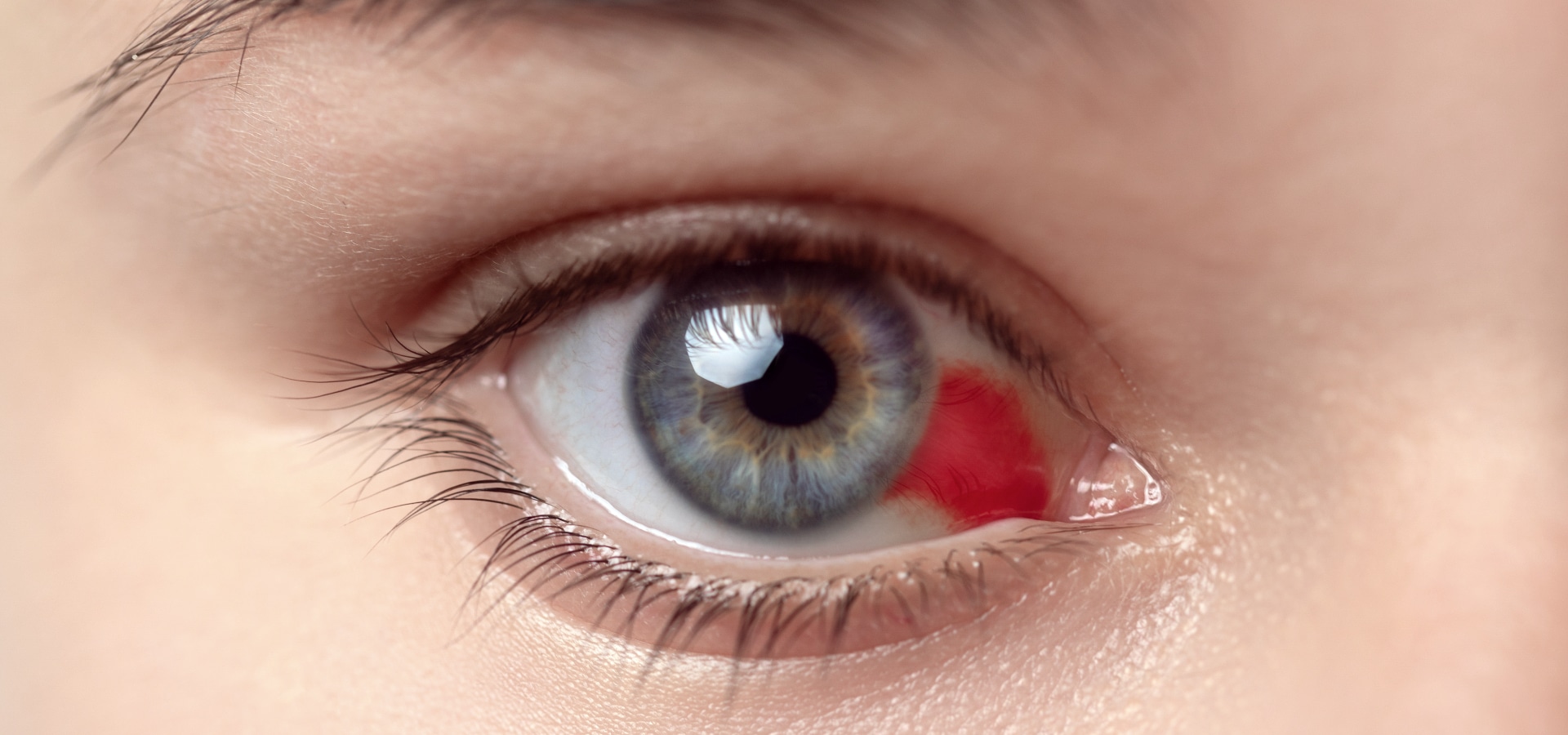 ¿Cómo saber si tienes la córnea dañada y cómo tratarla? » cornea del ojo dañada