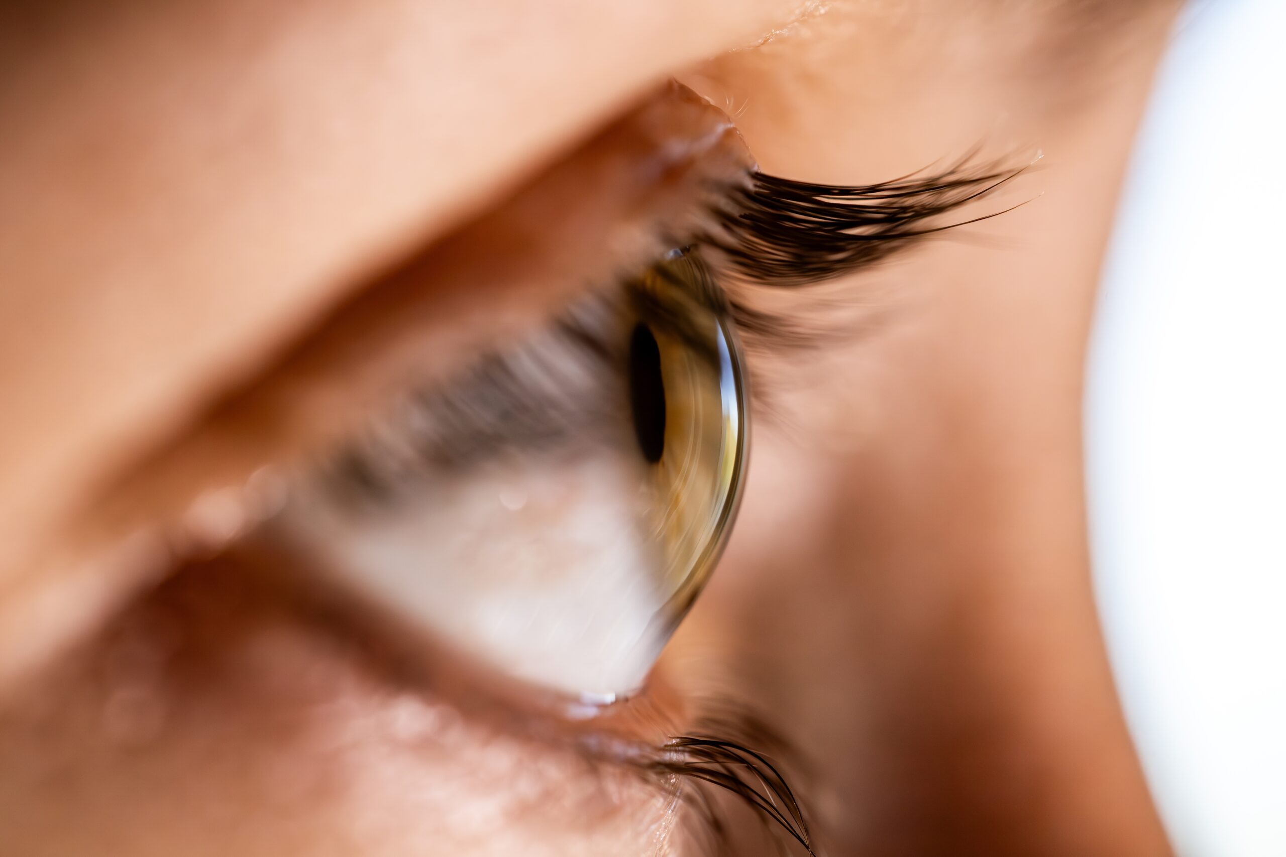 5 Enfermedades de la retina más comunes