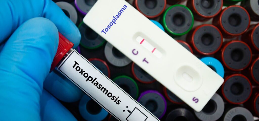 En este artículo aprenderemos qué es la toxoplasmosis ocular, cómo identificar sus principales síntomas y cuál es el tratamiento más adecuado.
