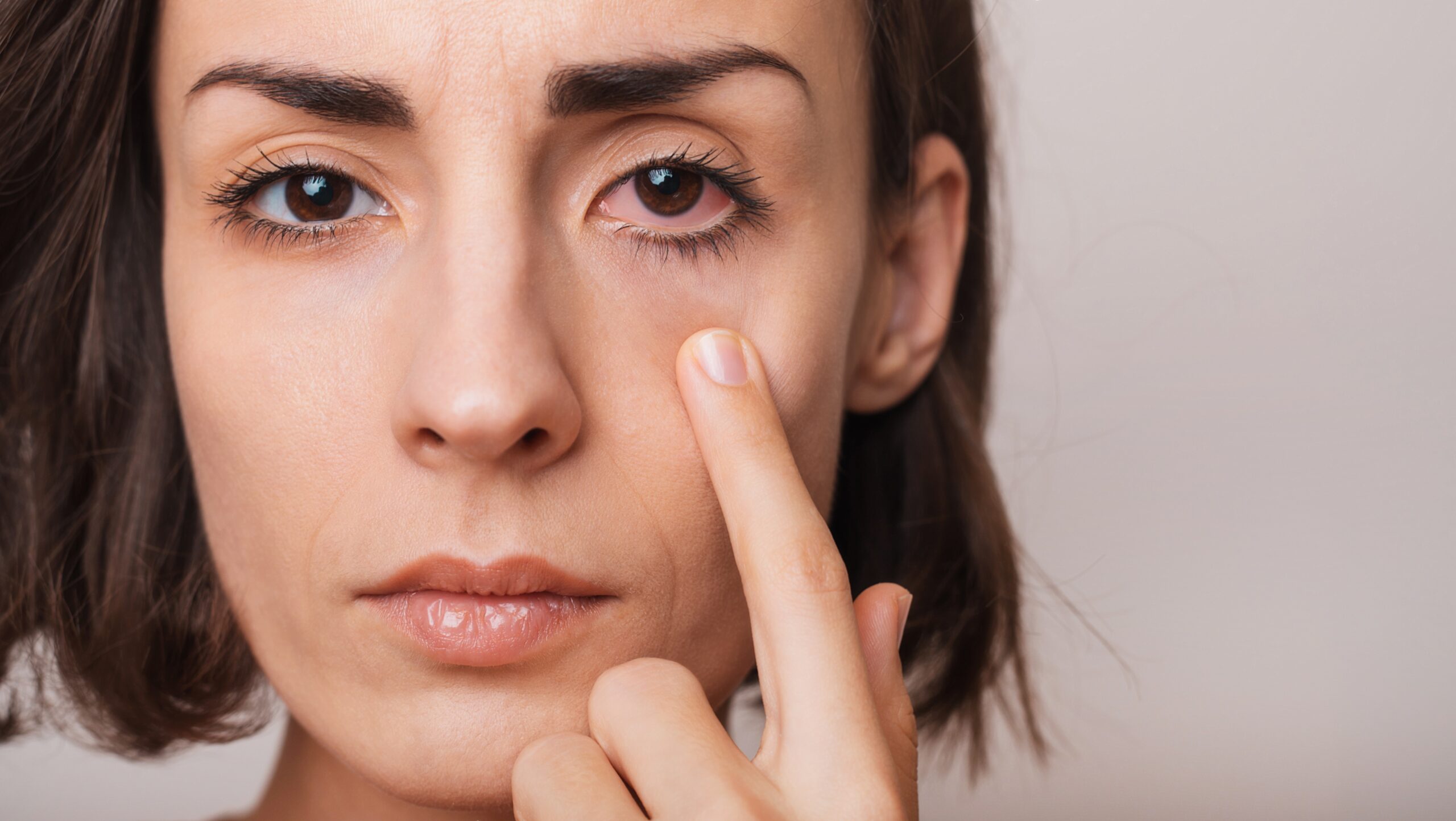 Ojos irritados Causas y tratamientos - OPC 1
