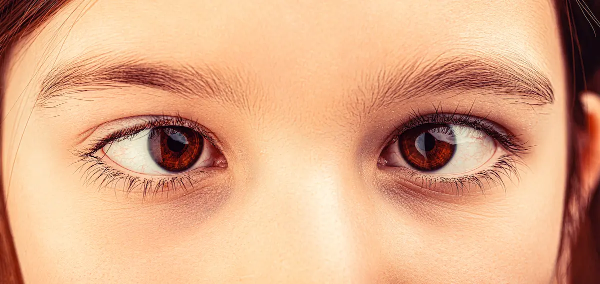 Nistagmo o nistagmus