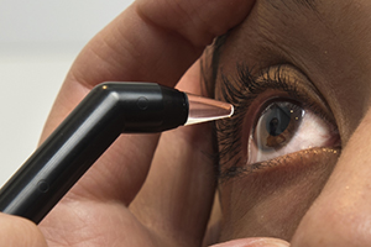 Paquimetría corneal: ¿para qué sirve este examen?