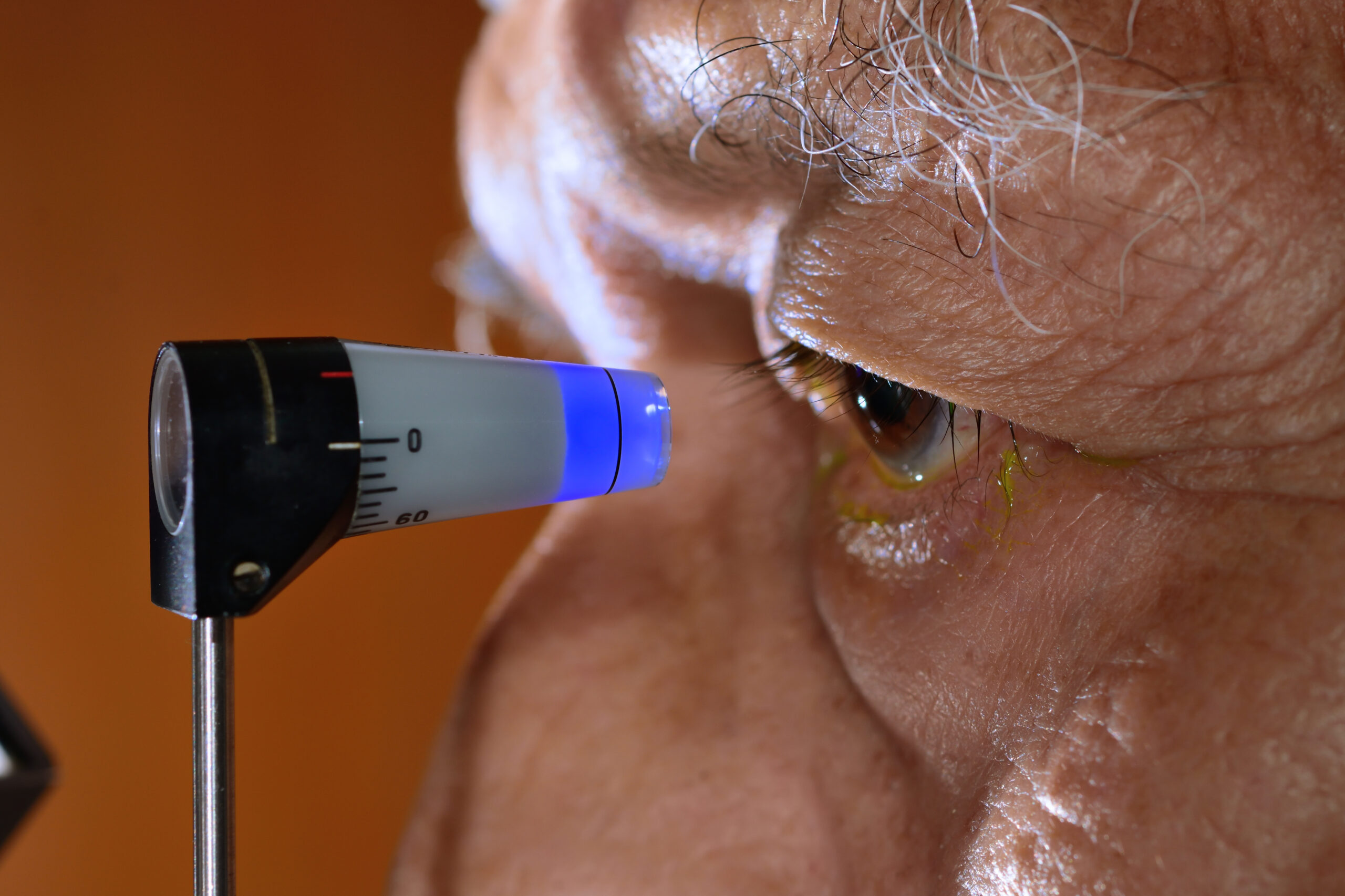 Tonometría examen ocular