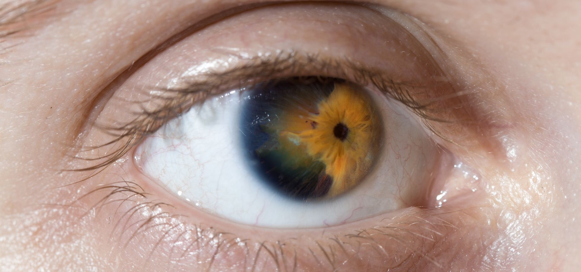 El epitelio corneal es la primera línea de defensa que protege tus ojos del mundo exterior.
