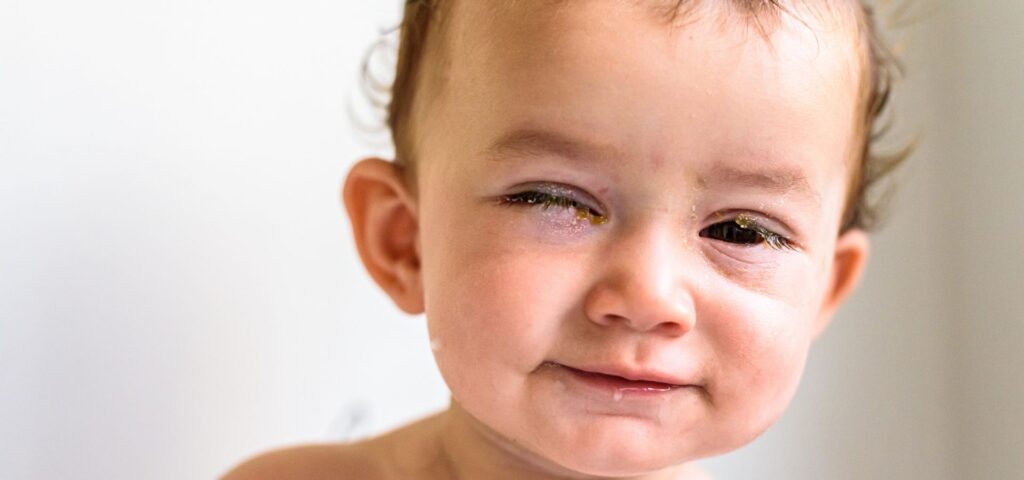 Las legañas en los ojos son acumulaciones naturales que aparecen principalmente al despertar.