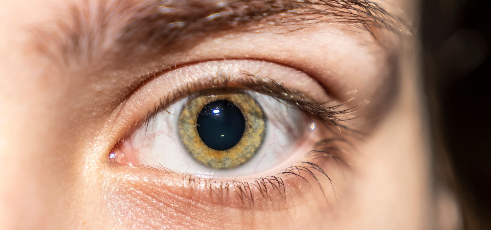 La midriasis puede ser la primera señal de alerta que envía el cuerpo sobre una condición que requiere atención inmediata.