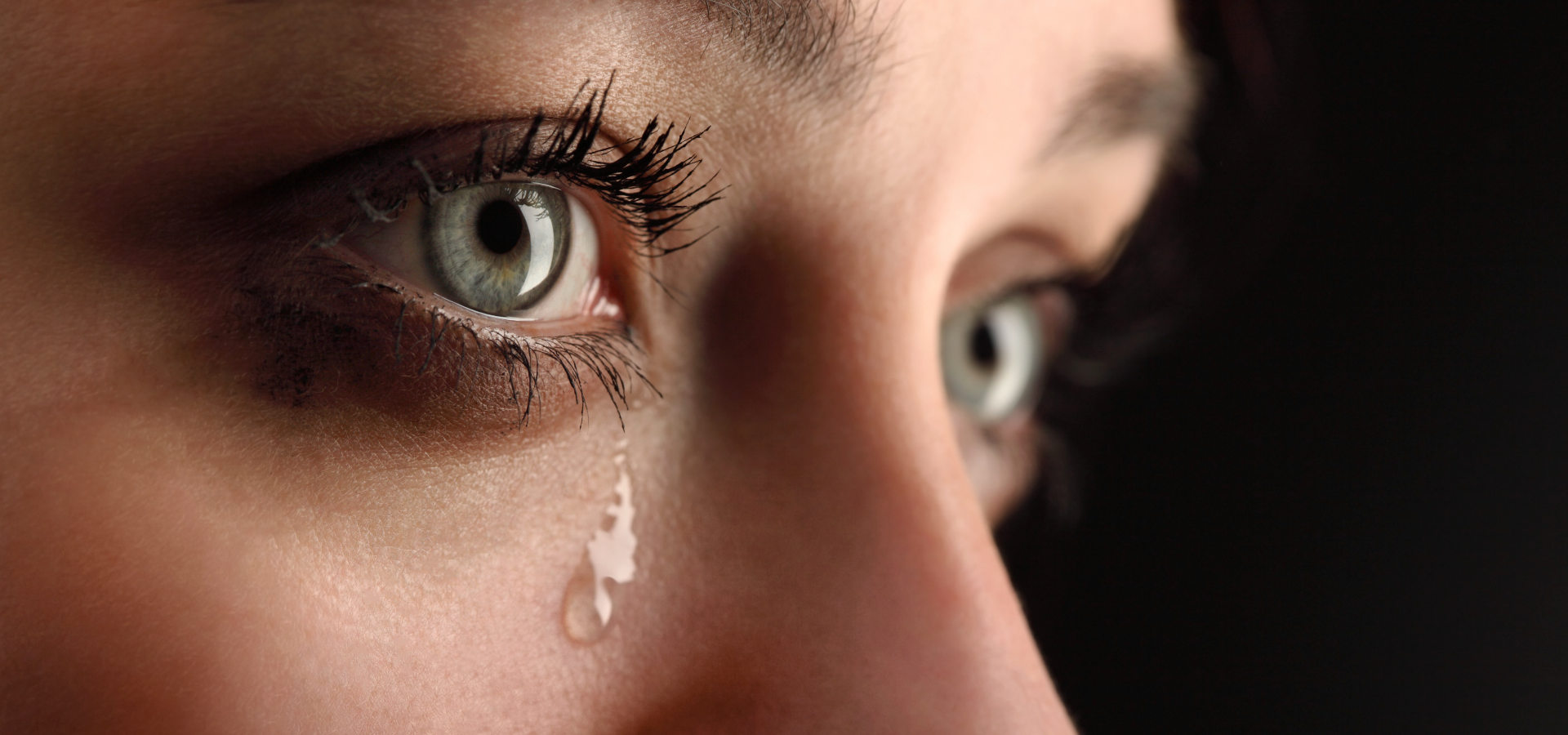 Mujer con lagrimeo constante de un ojo.