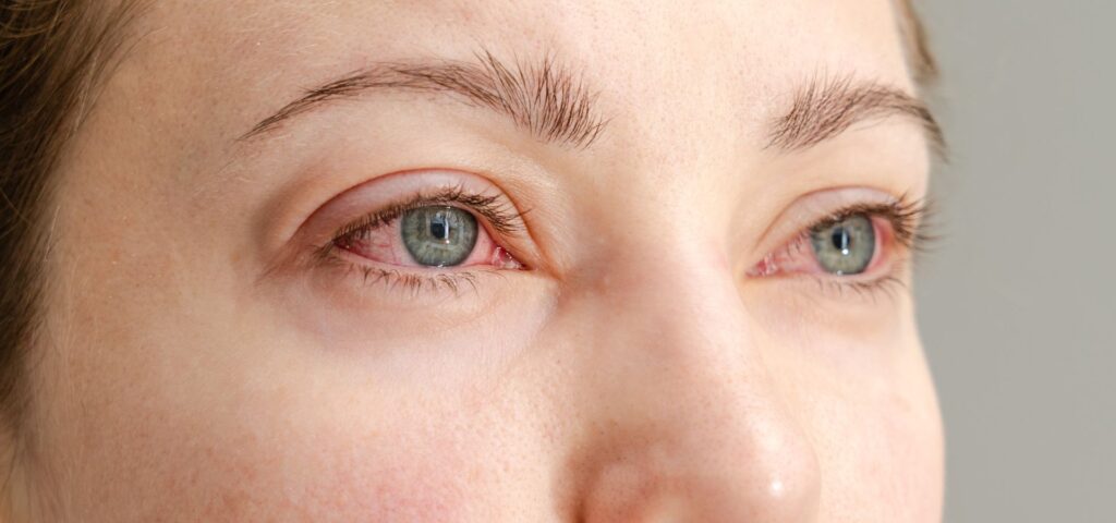 En esta guía, descubrirás los principales tipos de alergias en los ojos en niños y adultos, cómo identificar cada una y los tratamientos más efectivos.